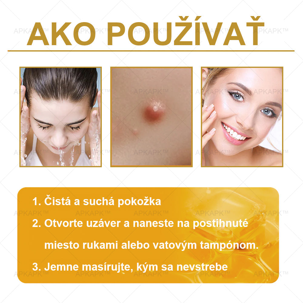 𝐀𝐏𝐊𝐀𝐏𝐊™ 𝐕č𝐞𝐥í 𝐉𝐞𝐝 𝐊𝐫é𝐦 𝐍𝐚 𝐑𝐞𝐠𝐞𝐧𝐞𝐫á𝐜𝐢𝐮 𝐏𝐥𝐞𝐭𝐢 🧑⚕️𝐎š𝐞𝐭𝐫𝐞𝐧𝐢𝐞 𝐤𝐨ž𝐧ý𝐜𝐡 𝐩𝐫𝐨𝐛𝐥é𝐦𝐨𝐯 𝐳𝐚𝐡ŕň𝐚: 𝐯𝐞𝐤𝐨𝐯é š𝐤𝐯𝐫𝐧𝐲, 𝐣𝐚𝐳𝐯𝐲, 𝐛𝐫𝐚𝐝𝐚𝐯𝐢𝐜𝐞, 𝐤𝐨ž𝐧é 𝐯ý𝐫𝐚𝐬𝐭𝐤𝐲, 𝐟𝐮𝐫𝐮𝐧𝐤𝐥𝐲, 𝐚𝐤𝐧é, 𝐞𝐤𝐳é𝐦𝐲, 𝐩𝐬𝐨𝐫𝐢á𝐳𝐮, 𝐚𝐤𝐧é 𝐢𝐧𝐯𝐞𝐫𝐬𝐚, 𝐯𝐫á𝐬𝐤𝐲, 𝐬𝐭𝐚𝐫𝐧𝐮𝐭𝐢𝐞 𝐩𝐥𝐞𝐭𝐢 𝐚 ď𝐚𝐥š𝐢𝐞.🔥