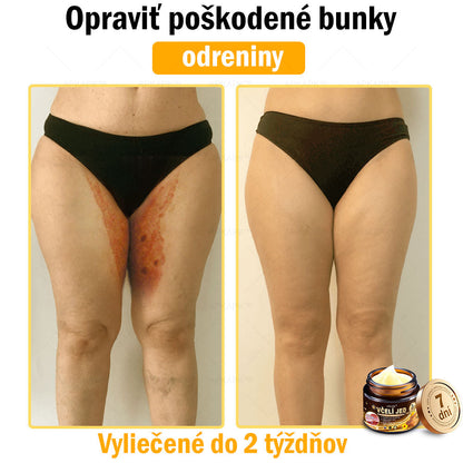 𝐀𝐏𝐊𝐀𝐏𝐊™ 𝐕č𝐞𝐥í 𝐉𝐞𝐝 𝐊𝐫é𝐦 𝐍𝐚 𝐑𝐞𝐠𝐞𝐧𝐞𝐫á𝐜𝐢𝐮 𝐏𝐥𝐞𝐭𝐢 🧑‍⚕️𝐎š𝐞𝐭𝐫𝐞𝐧𝐢𝐞 𝐤𝐨ž𝐧ý𝐜𝐡 𝐩𝐫𝐨𝐛𝐥é𝐦𝐨𝐯 𝐳𝐚𝐡ŕň𝐚: 𝐯𝐞𝐤𝐨𝐯é š𝐤𝐯𝐫𝐧𝐲, 𝐣𝐚𝐳𝐯𝐲, 𝐛𝐫𝐚𝐝𝐚𝐯𝐢𝐜𝐞, 𝐤𝐨ž𝐧é 𝐯ý𝐫𝐚𝐬𝐭𝐤𝐲, 𝐟𝐮𝐫𝐮𝐧𝐤𝐥𝐲, 𝐚𝐤𝐧é, 𝐞𝐤𝐳é𝐦𝐲, 𝐩𝐬𝐨𝐫𝐢á𝐳𝐮, 𝐚𝐤𝐧é 𝐢𝐧𝐯𝐞𝐫𝐬𝐚, 𝐯𝐫á𝐬𝐤𝐲, 𝐬𝐭𝐚𝐫𝐧𝐮𝐭𝐢𝐞 𝐩𝐥𝐞𝐭𝐢 𝐚 ď𝐚𝐥š𝐢𝐞.🔥