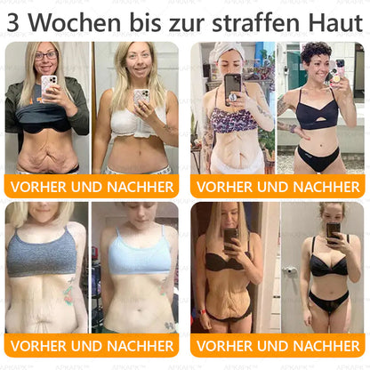 Hergestellt und versendet aus Deutschland ✨ APKAPK® Bienengift Umfassende Creme 🔥 LETZTER TAG 80 % RABATT 🌟
