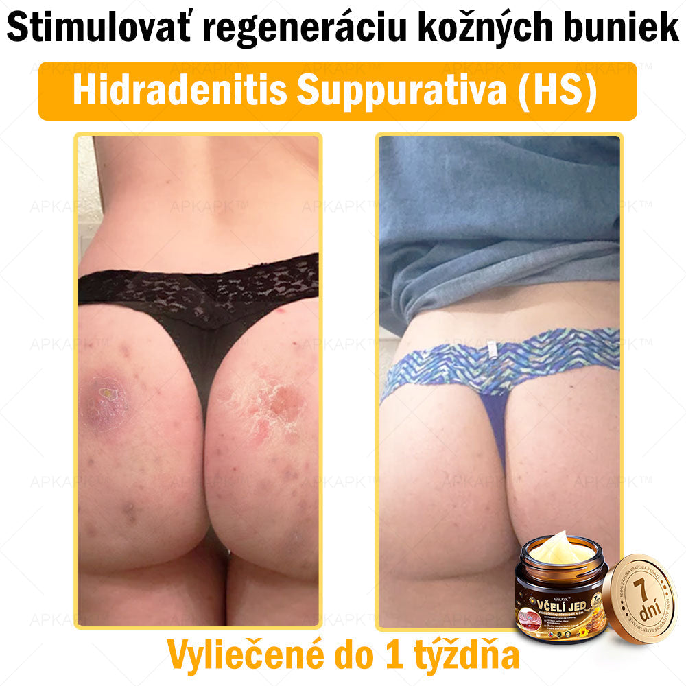 𝐀𝐏𝐊𝐀𝐏𝐊™ 𝐕č𝐞𝐥í 𝐉𝐞𝐝 𝐊𝐫é𝐦 𝐍𝐚 𝐑𝐞𝐠𝐞𝐧𝐞𝐫á𝐜𝐢𝐮 𝐏𝐥𝐞𝐭𝐢 🧑‍⚕️𝐎š𝐞𝐭𝐫𝐞𝐧𝐢𝐞 𝐤𝐨ž𝐧ý𝐜𝐡 𝐩𝐫𝐨𝐛𝐥é𝐦𝐨𝐯 𝐳𝐚𝐡ŕň𝐚: 𝐯𝐞𝐤𝐨𝐯é š𝐤𝐯𝐫𝐧𝐲, 𝐣𝐚𝐳𝐯𝐲, 𝐛𝐫𝐚𝐝𝐚𝐯𝐢𝐜𝐞, 𝐤𝐨ž𝐧é 𝐯ý𝐫𝐚𝐬𝐭𝐤𝐲, 𝐟𝐮𝐫𝐮𝐧𝐤𝐥𝐲, 𝐚𝐤𝐧é, 𝐞𝐤𝐳é𝐦𝐲, 𝐩𝐬𝐨𝐫𝐢á𝐳𝐮, 𝐚𝐤𝐧é 𝐢𝐧𝐯𝐞𝐫𝐬𝐚, 𝐯𝐫á𝐬𝐤𝐲, 𝐬𝐭𝐚𝐫𝐧𝐮𝐭𝐢𝐞 𝐩𝐥𝐞𝐭𝐢 𝐚 ď𝐚𝐥š𝐢𝐞.🔥