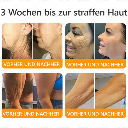 Hergestellt und versendet aus Deutschland ✨ APKAPK® Bienengift Umfassende Creme 🔥 LETZTER TAG 80 % RABATT 🌟
