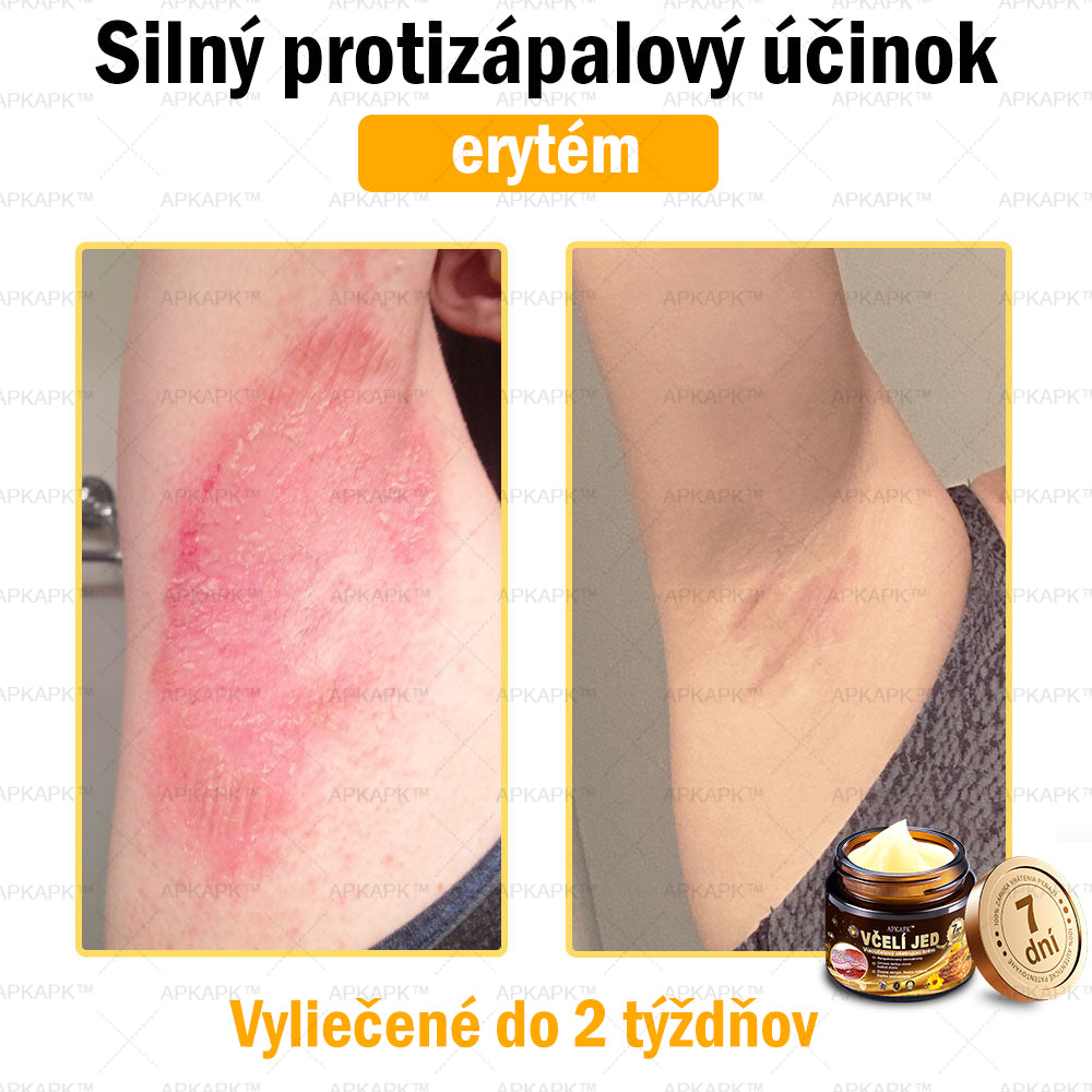 𝐀𝐏𝐊𝐀𝐏𝐊™ 𝐕č𝐞𝐥í 𝐉𝐞𝐝 𝐊𝐫é𝐦 𝐍𝐚 𝐑𝐞𝐠𝐞𝐧𝐞𝐫á𝐜𝐢𝐮 𝐏𝐥𝐞𝐭𝐢