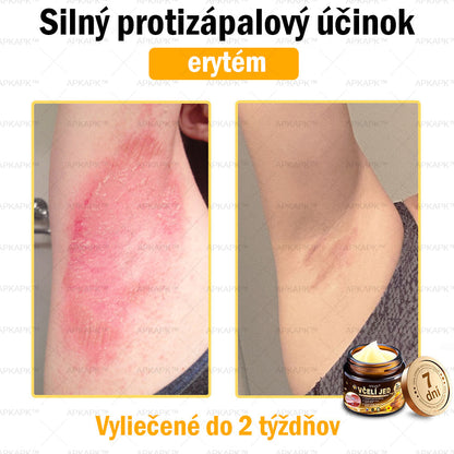 𝐀𝐏𝐊𝐀𝐏𝐊™ 𝐕č𝐞𝐥í 𝐉𝐞𝐝 𝐊𝐫é𝐦 𝐍𝐚 𝐑𝐞𝐠𝐞𝐧𝐞𝐫á𝐜𝐢𝐮 𝐏𝐥𝐞𝐭𝐢 🧑‍⚕️𝐎š𝐞𝐭𝐫𝐞𝐧𝐢𝐞 𝐤𝐨ž𝐧ý𝐜𝐡 𝐩𝐫𝐨𝐛𝐥é𝐦𝐨𝐯 𝐳𝐚𝐡ŕň𝐚: 𝐯𝐞𝐤𝐨𝐯é š𝐤𝐯𝐫𝐧𝐲, 𝐣𝐚𝐳𝐯𝐲, 𝐛𝐫𝐚𝐝𝐚𝐯𝐢𝐜𝐞, 𝐤𝐨ž𝐧é 𝐯ý𝐫𝐚𝐬𝐭𝐤𝐲, 𝐟𝐮𝐫𝐮𝐧𝐤𝐥𝐲, 𝐚𝐤𝐧é, 𝐞𝐤𝐳é𝐦𝐲, 𝐩𝐬𝐨𝐫𝐢á𝐳𝐮, 𝐚𝐤𝐧é 𝐢𝐧𝐯𝐞𝐫𝐬𝐚, 𝐯𝐫á𝐬𝐤𝐲, 𝐬𝐭𝐚𝐫𝐧𝐮𝐭𝐢𝐞 𝐩𝐥𝐞𝐭𝐢 𝐚 ď𝐚𝐥š𝐢𝐞.🔥