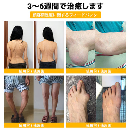 🤞ZUWIAY® ハチ毒配合 痛み緩和・骨の治癒クリーム 🎊🎊（特に高齢者向け）