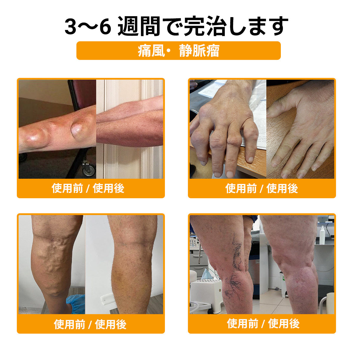 🤞ZUWIAY® ハチ毒配合 痛み緩和・骨の治癒クリーム 🎊🎊（特に高齢者向け）