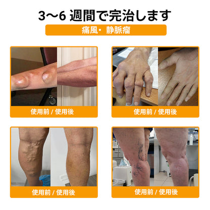 🤞ZUWIAY® ハチ毒配合 痛み緩和・骨の治癒クリーム 🎊🎊（特に高齢者向け）