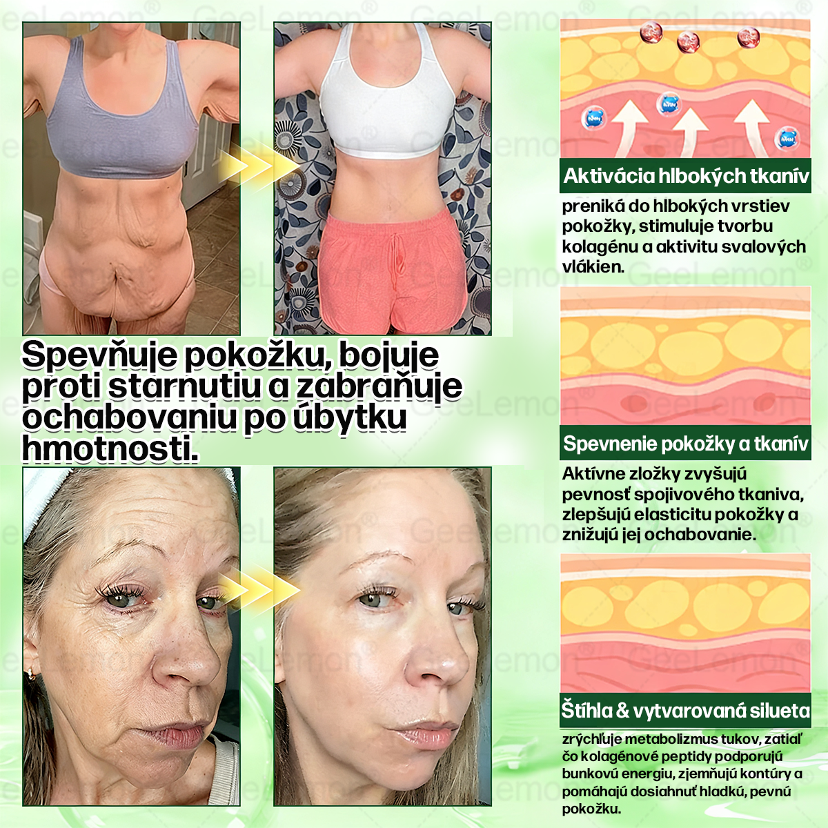 GeeLemon®🎶 Moringa · Berberín × NAD+ 10 v 1 Pokročilý Nano Mikroihličkový Náplasťový Systém ✅ (Stačí raz denne, viditeľné zmeny do 7 dní) Pri obezite, kardiovaskulárnom zdraví, cukrovke,  štítnej žľaze, zdraví čriev, problémoch s kĺbmi a ďalších