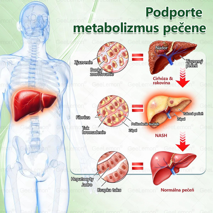 GeeLemon®🎶 Moringa · Berberín × NAD+ 10 v 1 Pokročilý Nano Mikroihličkový Náplasťový Systém ✅ (Stačí raz denne, viditeľné zmeny do 7 dní) Pri obezite, kardiovaskulárnom zdraví, cukrovke,  štítnej žľaze, zdraví čriev, problémoch s kĺbmi a ďalších