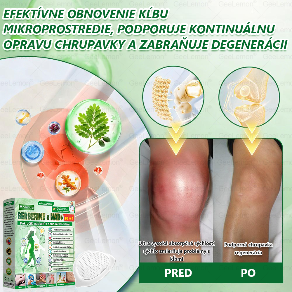 GeeLemon®🎶 Moringa · Berberín × NAD+ 10 v 1 Pokročilý Nano Mikroihličkový Náplasťový Systém ✅ (Stačí raz denne, viditeľné zmeny do 7 dní) Pri obezite, kardiovaskulárnom zdraví, cukrovke,  štítnej žľaze, zdraví čriev, problémoch s kĺbmi a ďalších