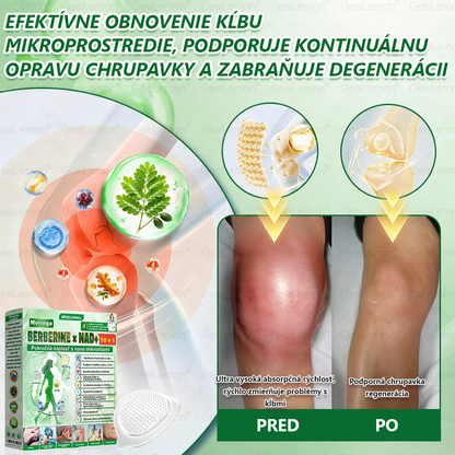 GeeLemon®🎶 Moringa · Berberín × NAD+ 10 v 1 Pokročilý Nano Mikroihličkový Náplasťový Systém ✅ (Stačí raz denne, viditeľné zmeny do 7 dní) Pri obezite, kardiovaskulárnom zdraví, cukrovke,  štítnej žľaze, zdraví čriev, problémoch s kĺbmi a ďalších