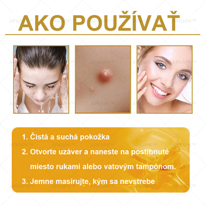 𝐀𝐏𝐊𝐀𝐏𝐊™ 𝐕č𝐞𝐥í 𝐉𝐞𝐝 𝐊𝐫é𝐦 𝐍𝐚 𝐑𝐞𝐠𝐞𝐧𝐞𝐫á𝐜𝐢𝐮 𝐏𝐥𝐞𝐭𝐢