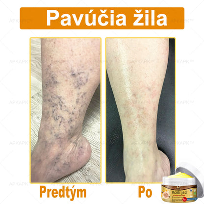 🌿𝐔ž 𝐥𝐞𝐧 𝟓 𝐛𝐚𝐥𝐞𝐧í 𝐳𝐨𝐬𝐭𝐚𝐥𝐨! 𝐏𝐨𝐬𝐤𝐲𝐭𝐮𝐣𝐞𝐦𝐞 ď𝐚𝐥ší𝐜𝐡 𝟓𝟎% 𝐳ľ𝐚𝐯𝐮! 𝐙𝐝𝐫𝐚𝐯š𝐢𝐞 𝐭𝐞𝐥𝐨 𝐣𝐞 𝐧𝐚 𝐝𝐨𝐬𝐚𝐡! 𝐀𝐤 𝐭𝐞𝐫𝐚𝐳 𝐳𝐦𝐞š𝐤áš, 𝐝𝐨𝐬𝐭𝐚𝐧𝐞š 𝐭𝐨 𝐚ž 𝐛𝐮𝐝ú𝐜𝐢 𝐫𝐨𝐤.