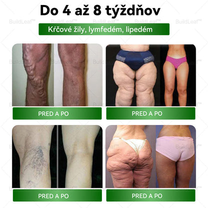 💪Odporúčané klinikou Mayo | Oficiálny obchod | BuildLeaf® GLP-1 Moringa Slimming & Health Boost Drops🔥 (Spaľovač tukov potravinárskej kvality – vyvinutý Spoločnosťou pre obezitu)