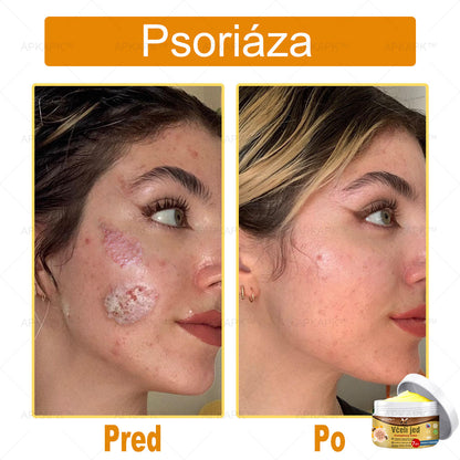 🌿𝐔ž 𝐥𝐞𝐧 𝟓 𝐛𝐚𝐥𝐞𝐧í 𝐳𝐨𝐬𝐭𝐚𝐥𝐨! 𝐏𝐨𝐬𝐤𝐲𝐭𝐮𝐣𝐞𝐦𝐞 ď𝐚𝐥ší𝐜𝐡 𝟓𝟎% 𝐳ľ𝐚𝐯𝐮! 𝐙𝐝𝐫𝐚𝐯š𝐢𝐞 𝐭𝐞𝐥𝐨 𝐣𝐞 𝐧𝐚 𝐝𝐨𝐬𝐚𝐡! 𝐀𝐤 𝐭𝐞𝐫𝐚𝐳 𝐳𝐦𝐞š𝐤áš, 𝐝𝐨𝐬𝐭𝐚𝐧𝐞š 𝐭𝐨 𝐚ž 𝐛𝐮𝐝ú𝐜𝐢 𝐫𝐨𝐤.
