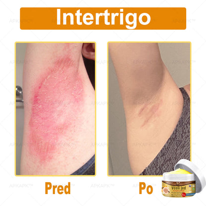 🌿𝐔ž 𝐥𝐞𝐧 𝟓 𝐛𝐚𝐥𝐞𝐧í 𝐳𝐨𝐬𝐭𝐚𝐥𝐨! 𝐏𝐨𝐬𝐤𝐲𝐭𝐮𝐣𝐞𝐦𝐞 ď𝐚𝐥ší𝐜𝐡 𝟓𝟎% 𝐳ľ𝐚𝐯𝐮! 𝐙𝐝𝐫𝐚𝐯š𝐢𝐞 𝐭𝐞𝐥𝐨 𝐣𝐞 𝐧𝐚 𝐝𝐨𝐬𝐚𝐡! 𝐀𝐤 𝐭𝐞𝐫𝐚𝐳 𝐳𝐦𝐞š𝐤áš, 𝐝𝐨𝐬𝐭𝐚𝐧𝐞š 𝐭𝐨 𝐚ž 𝐛𝐮𝐝ú𝐜𝐢 𝐫𝐨𝐤.
