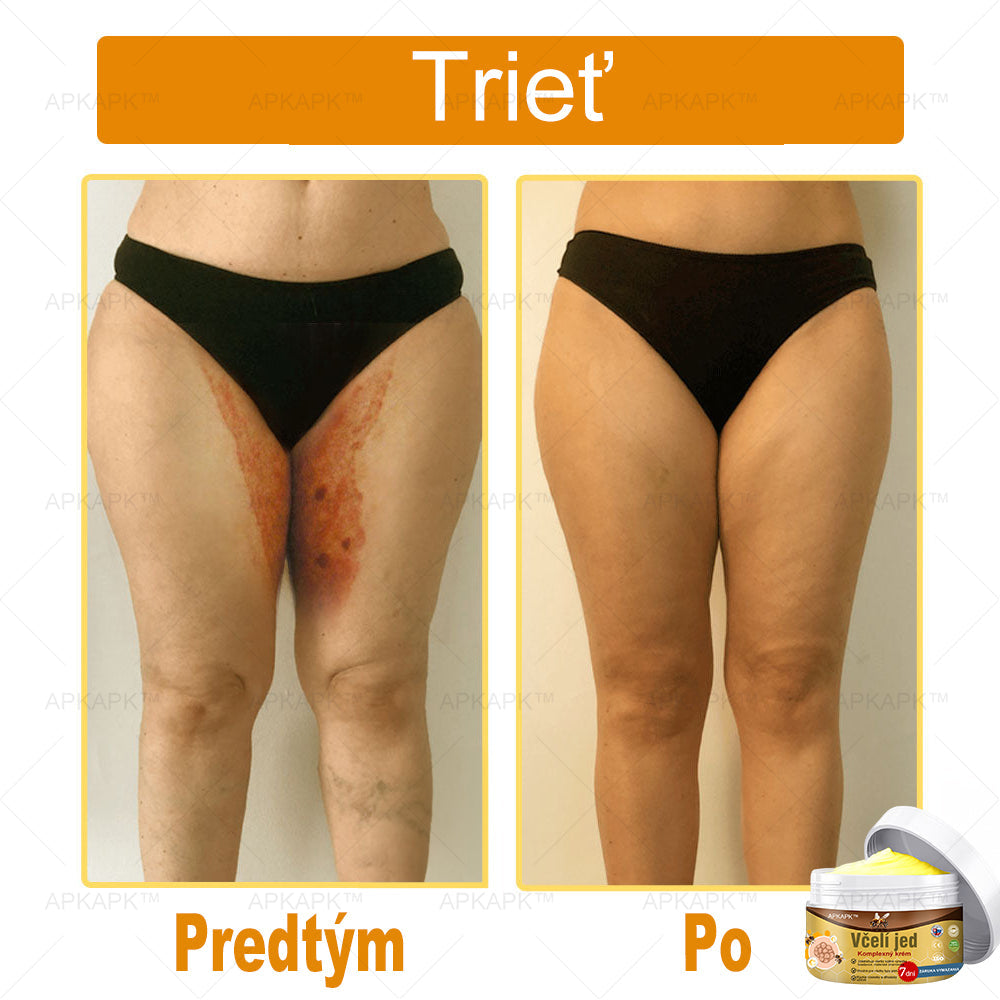 🌿𝐔ž 𝐥𝐞𝐧 𝟓 𝐛𝐚𝐥𝐞𝐧í 𝐳𝐨𝐬𝐭𝐚𝐥𝐨! 𝐏𝐨𝐬𝐤𝐲𝐭𝐮𝐣𝐞𝐦𝐞 ď𝐚𝐥ší𝐜𝐡 𝟓𝟎% 𝐳ľ𝐚𝐯𝐮! 𝐙𝐝𝐫𝐚𝐯š𝐢𝐞 𝐭𝐞𝐥𝐨 𝐣𝐞 𝐧𝐚 𝐝𝐨𝐬𝐚𝐡! 𝐀𝐤 𝐭𝐞𝐫𝐚𝐳 𝐳𝐦𝐞š𝐤áš, 𝐝𝐨𝐬𝐭𝐚𝐧𝐞š 𝐭𝐨 𝐚ž 𝐛𝐮𝐝ú𝐜𝐢 𝐫𝐨𝐤.