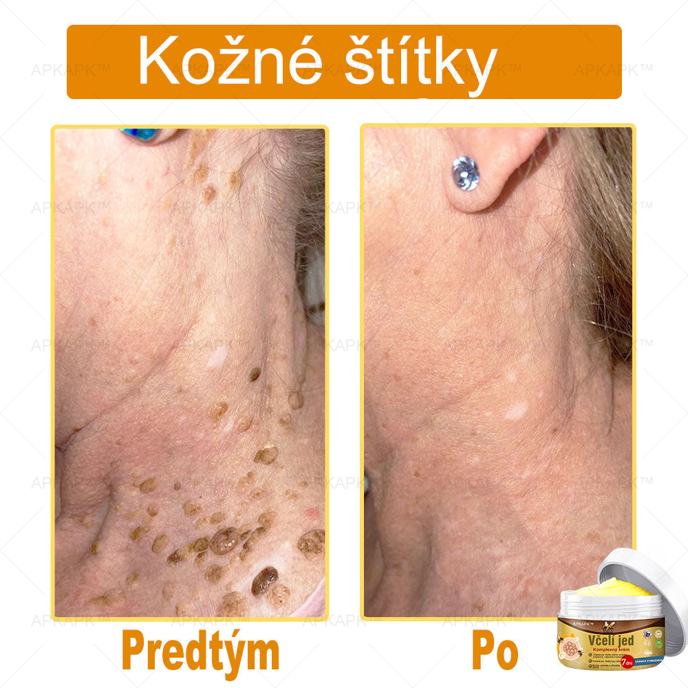 🌿𝐔ž 𝐥𝐞𝐧 𝟓 𝐛𝐚𝐥𝐞𝐧í 𝐳𝐨𝐬𝐭𝐚𝐥𝐨! 𝐏𝐨𝐬𝐤𝐲𝐭𝐮𝐣𝐞𝐦𝐞 ď𝐚𝐥ší𝐜𝐡 𝟓𝟎% 𝐳ľ𝐚𝐯𝐮! 𝐙𝐝𝐫𝐚𝐯š𝐢𝐞 𝐭𝐞𝐥𝐨 𝐣𝐞 𝐧𝐚 𝐝𝐨𝐬𝐚𝐡! 𝐀𝐤 𝐭𝐞𝐫𝐚𝐳 𝐳𝐦𝐞š𝐤áš, 𝐝𝐨𝐬𝐭𝐚𝐧𝐞š 𝐭𝐨 𝐚ž 𝐛𝐮𝐝ú𝐜𝐢 𝐫𝐨𝐤.