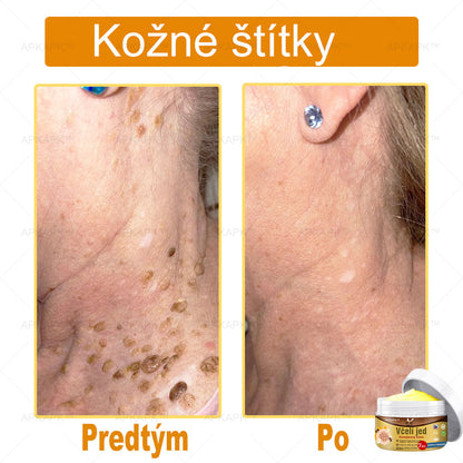 🌿𝐔ž 𝐥𝐞𝐧 𝟓 𝐛𝐚𝐥𝐞𝐧í 𝐳𝐨𝐬𝐭𝐚𝐥𝐨! 𝐏𝐨𝐬𝐤𝐲𝐭𝐮𝐣𝐞𝐦𝐞 ď𝐚𝐥ší𝐜𝐡 𝟓𝟎% 𝐳ľ𝐚𝐯𝐮! 𝐙𝐝𝐫𝐚𝐯š𝐢𝐞 𝐭𝐞𝐥𝐨 𝐣𝐞 𝐧𝐚 𝐝𝐨𝐬𝐚𝐡! 𝐀𝐤 𝐭𝐞𝐫𝐚𝐳 𝐳𝐦𝐞š𝐤áš, 𝐝𝐨𝐬𝐭𝐚𝐧𝐞š 𝐭𝐨 𝐚ž 𝐛𝐮𝐝ú𝐜𝐢 𝐫𝐨𝐤.