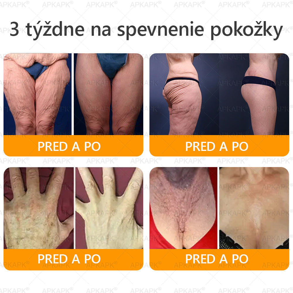 Vyrobené a odoslané zo Slovenska 💖𝖠𝖯𝖪𝖠𝖯𝖪® 𝖡𝖾𝖾 𝗏𝖾𝗇𝗈𝗆 𝖪𝗋𝖾𝗆 𝗇𝖺 𝗈𝗉𝗋𝖺𝗏𝗎 𝗉𝗅𝖾𝗍𝗂