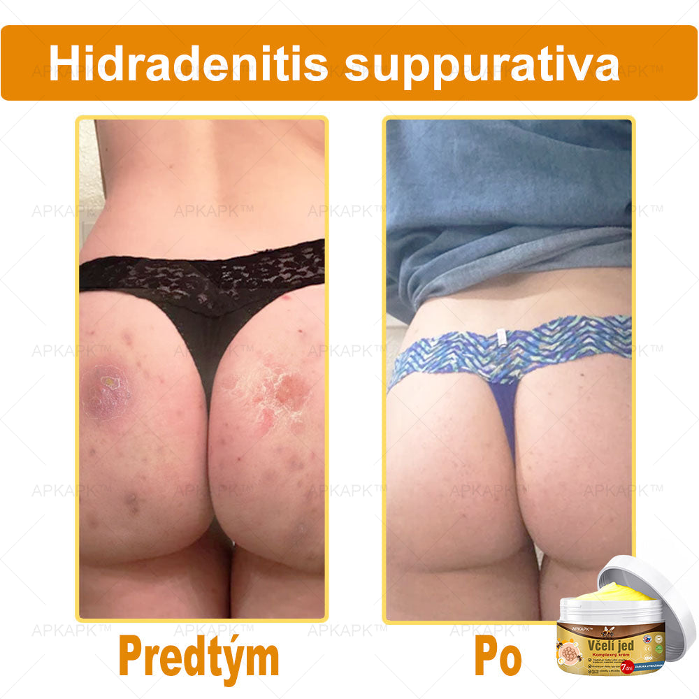 🌿𝐔ž 𝐥𝐞𝐧 𝟓 𝐛𝐚𝐥𝐞𝐧í 𝐳𝐨𝐬𝐭𝐚𝐥𝐨! 𝐏𝐨𝐬𝐤𝐲𝐭𝐮𝐣𝐞𝐦𝐞 ď𝐚𝐥ší𝐜𝐡 𝟓𝟎% 𝐳ľ𝐚𝐯𝐮! 𝐙𝐝𝐫𝐚𝐯š𝐢𝐞 𝐭𝐞𝐥𝐨 𝐣𝐞 𝐧𝐚 𝐝𝐨𝐬𝐚𝐡! 𝐀𝐤 𝐭𝐞𝐫𝐚𝐳 𝐳𝐦𝐞š𝐤áš, 𝐝𝐨𝐬𝐭𝐚𝐧𝐞š 𝐭𝐨 𝐚ž 𝐛𝐮𝐝ú𝐜𝐢 𝐫𝐨𝐤.
