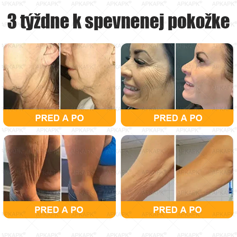Vyrobené a odoslané zo Slovenska 💖𝖠𝖯𝖪𝖠𝖯𝖪® 𝖡𝖾𝖾 𝗏𝖾𝗇𝗈𝗆 𝖪𝗋𝖾𝗆 𝗇𝖺 𝗈𝗉𝗋𝖺𝗏𝗎 𝗉𝗅𝖾𝗍𝗂