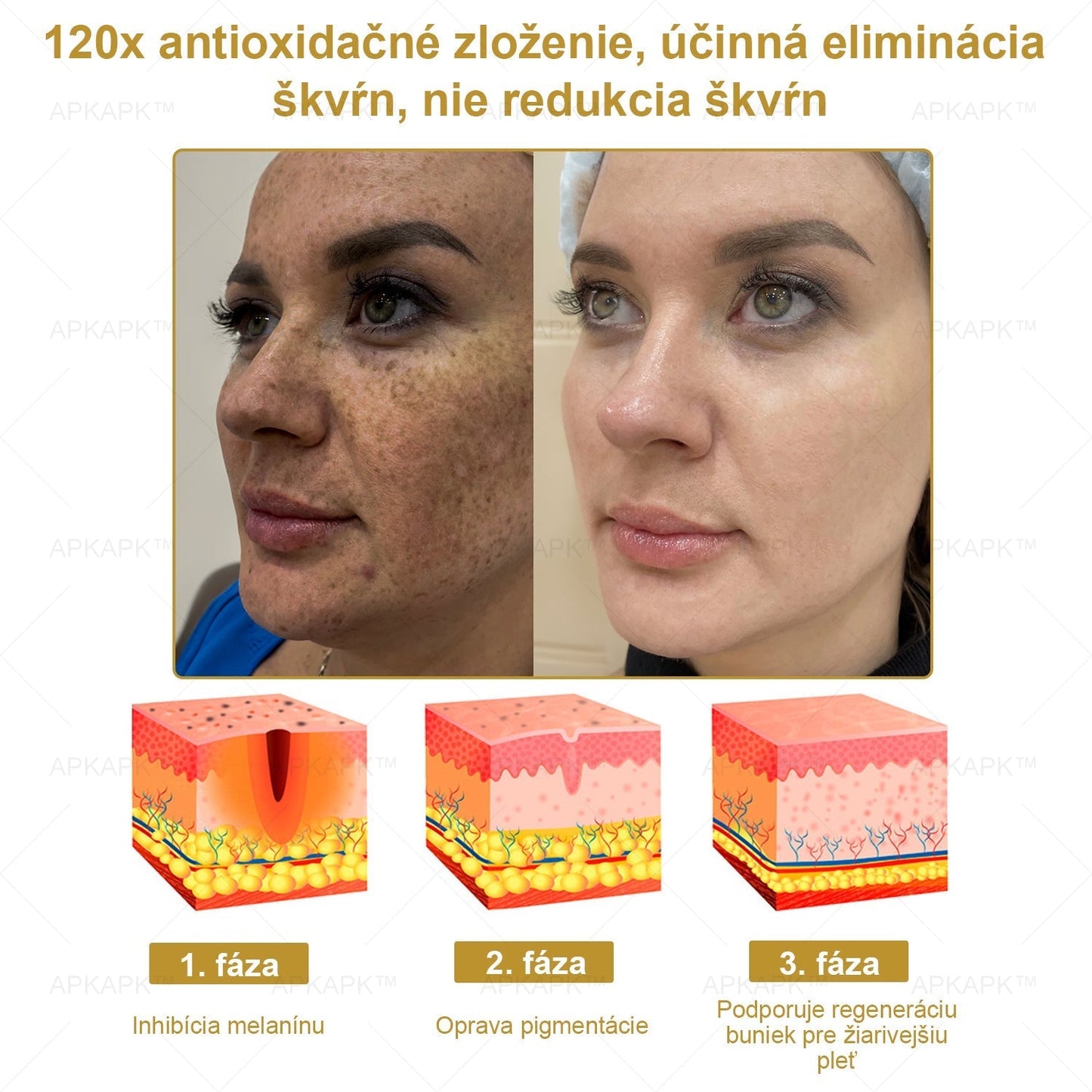 𝐀𝐏𝐊𝐀𝐏𝐊® 𝐕Š𝐄𝐓𝐊𝐎 𝐕 𝐉𝐄𝐃𝐍𝐎𝐌 𝐊𝐫é𝐦 𝐧𝐚 𝐨š𝐞𝐭𝐫𝐞𝐧𝐢𝐞 𝐩𝐨𝐤𝐨ž𝐤𝐲(❄ Nový zimný predaj | ❄ Až do 70% vypnuté)