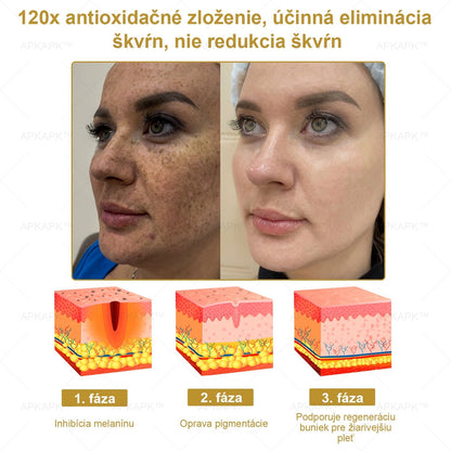 𝐀𝐏𝐊𝐀𝐏𝐊® 𝐕Š𝐄𝐓𝐊𝐎 𝐕 𝐉𝐄𝐃𝐍𝐎𝐌 𝐊𝐫é𝐦 𝐧𝐚 𝐨š𝐞𝐭𝐫𝐞𝐧𝐢𝐞 𝐩𝐨𝐤𝐨ž𝐤𝐲(❄ Nový zimný predaj | ❄ Až do 70% vypnuté)