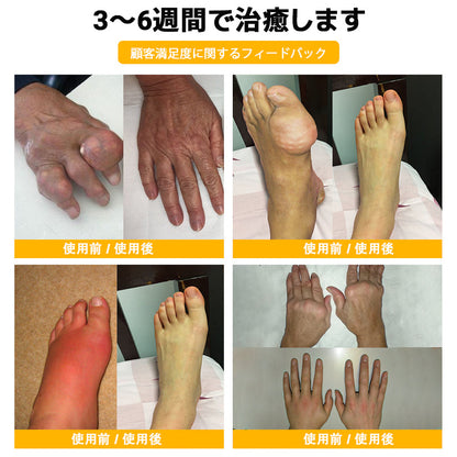 🤞ZUWIAY® ハチ毒配合 痛み緩和・骨の治癒クリーム 🎊🎊（特に高齢者向け）