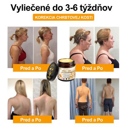 𝐎𝐟𝐢𝐜𝐢á𝐥𝐧𝐲 𝐨𝐛𝐜𝐡𝐨𝐝:𝐙𝐕𝐋𝐙𝐕𝐋™ 🐝𝐕č𝐞𝐥í 𝐣𝐞𝐝 𝐨𝐤𝐚𝐦ž𝐢𝐭ý 𝐮𝐥𝐭𝐫𝐚 𝐬𝐢𝐥𝐧ý 𝐤𝐫é𝐦 𝐩𝐫𝐨𝐭𝐢 𝐛𝐨𝐥𝐞𝐬𝐭𝐢 - (𝐳𝐦𝐢𝐞𝐫ň𝐮𝐣𝐞 𝐛𝐨𝐥𝐞𝐬ť 𝐩𝐫𝐢 𝐚𝐫𝐭𝐫𝐢𝐭í𝐝𝐞, 𝐛𝐨𝐥𝐞𝐬𝐭𝐢 𝐬𝐯𝐚𝐥𝐨𝐯, 𝐜𝐡𝐫𝐛𝐭𝐚, 𝐤𝐨𝐥𝐢𝐞𝐧, 𝐜𝐡𝐫𝐛𝐭𝐚, 𝐫𝐚𝐦𝐢𝐞𝐧, 𝐛𝐨𝐤𝐨𝐯, 𝐳á𝐩ä𝐬𝐭í, 𝐫ú𝐤)🔥