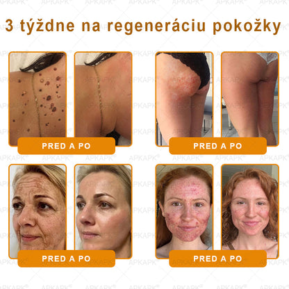 Vyrobené a odoslané zo Slovenska 💖𝖠𝖯𝖪𝖠𝖯𝖪® 𝖡𝖾𝖾 𝗏𝖾𝗇𝗈𝗆 𝖪𝗋𝖾𝗆 𝗇𝖺 𝗈𝗉𝗋𝖺𝗏𝗎 𝗉𝗅𝖾𝗍𝗂