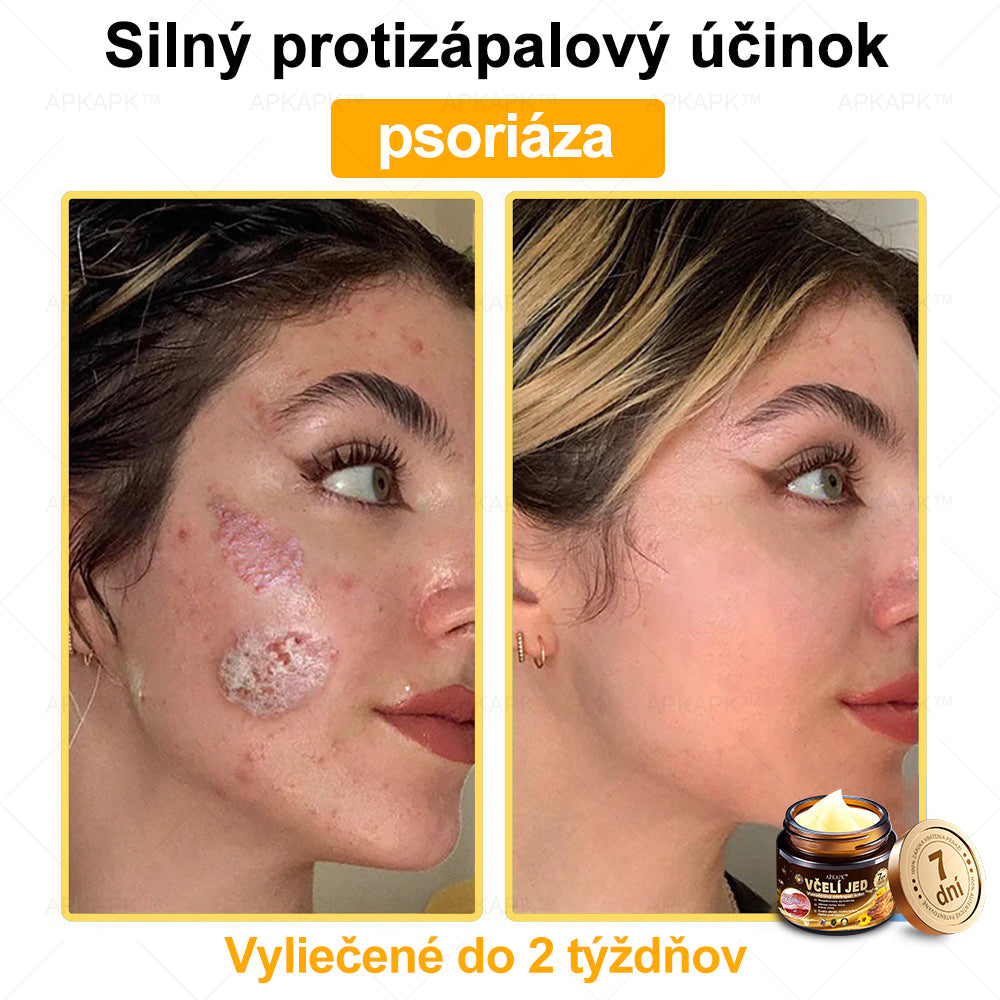 𝐀𝐏𝐊𝐀𝐏𝐊™ 𝐕č𝐞𝐥í 𝐉𝐞𝐝 𝐊𝐫é𝐦 𝐍𝐚 𝐑𝐞𝐠𝐞𝐧𝐞𝐫á𝐜𝐢𝐮 𝐏𝐥𝐞𝐭𝐢