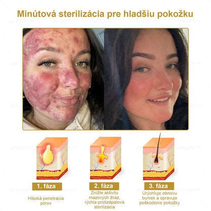 𝐀𝐏𝐊𝐀𝐏𝐊® 𝐕Š𝐄𝐓𝐊𝐎 𝐕 𝐉𝐄𝐃𝐍𝐎𝐌 𝐊𝐫é𝐦 𝐧𝐚 𝐨š𝐞𝐭𝐫𝐞𝐧𝐢𝐞 𝐩𝐨𝐤𝐨ž𝐤𝐲(❄ Nový zimný predaj | ❄ Až do 70% vypnuté)