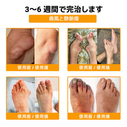 🤞ZUWIAY® ハチ毒配合 痛み緩和・骨の治癒クリーム 🎊🎊（特に高齢者向け）