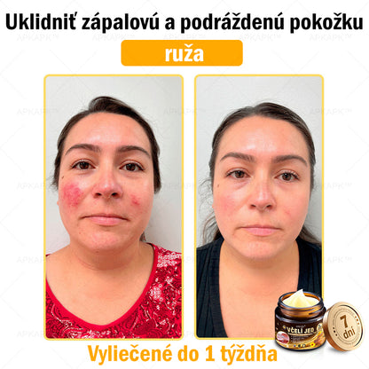 𝐀𝐏𝐊𝐀𝐏𝐊™ 𝐕č𝐞𝐥í 𝐉𝐞𝐝 𝐊𝐫é𝐦 𝐍𝐚 𝐑𝐞𝐠𝐞𝐧𝐞𝐫á𝐜𝐢𝐮 𝐏𝐥𝐞𝐭𝐢