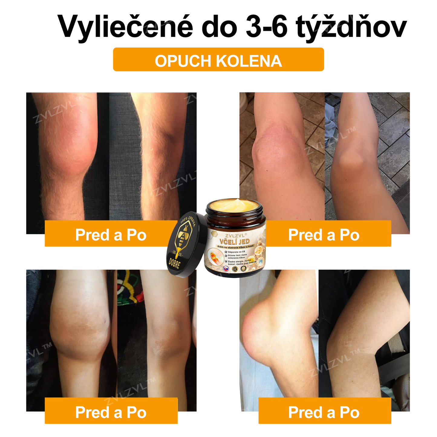 𝐎𝐟𝐢𝐜𝐢á𝐥𝐧𝐲 𝐨𝐛𝐜𝐡𝐨𝐝:𝐙𝐕𝐋𝐙𝐕𝐋™ 🐝𝐕č𝐞𝐥í 𝐣𝐞𝐝 𝐨𝐤𝐚𝐦ž𝐢𝐭ý 𝐮𝐥𝐭𝐫𝐚 𝐬𝐢𝐥𝐧ý 𝐤𝐫é𝐦 𝐩𝐫𝐨𝐭𝐢 𝐛𝐨𝐥𝐞𝐬𝐭𝐢 - (𝐳𝐦𝐢𝐞𝐫ň𝐮𝐣𝐞 𝐛𝐨𝐥𝐞𝐬ť 𝐩𝐫𝐢 𝐚𝐫𝐭𝐫𝐢𝐭í𝐝𝐞, 𝐛𝐨𝐥𝐞𝐬𝐭𝐢 𝐬𝐯𝐚𝐥𝐨𝐯, 𝐜𝐡𝐫𝐛𝐭𝐚, 𝐤𝐨𝐥𝐢𝐞𝐧, 𝐜𝐡𝐫𝐛𝐭𝐚, 𝐫𝐚𝐦𝐢𝐞𝐧, 𝐛𝐨𝐤𝐨𝐯, 𝐳á𝐩ä𝐬𝐭í, 𝐫ú𝐤)🔥