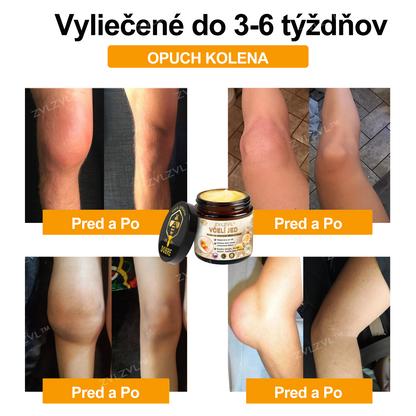 𝐎𝐟𝐢𝐜𝐢á𝐥𝐧𝐲 𝐨𝐛𝐜𝐡𝐨𝐝:𝐙𝐕𝐋𝐙𝐕𝐋™ 🐝𝐕č𝐞𝐥í 𝐣𝐞𝐝 𝐨𝐤𝐚𝐦ž𝐢𝐭ý 𝐮𝐥𝐭𝐫𝐚 𝐬𝐢𝐥𝐧ý 𝐤𝐫é𝐦 𝐩𝐫𝐨𝐭𝐢 𝐛𝐨𝐥𝐞𝐬𝐭𝐢 - (𝐳𝐦𝐢𝐞𝐫ň𝐮𝐣𝐞 𝐛𝐨𝐥𝐞𝐬ť 𝐩𝐫𝐢 𝐚𝐫𝐭𝐫𝐢𝐭í𝐝𝐞, 𝐛𝐨𝐥𝐞𝐬𝐭𝐢 𝐬𝐯𝐚𝐥𝐨𝐯, 𝐜𝐡𝐫𝐛𝐭𝐚, 𝐤𝐨𝐥𝐢𝐞𝐧, 𝐜𝐡𝐫𝐛𝐭𝐚, 𝐫𝐚𝐦𝐢𝐞𝐧, 𝐛𝐨𝐤𝐨𝐯, 𝐳á𝐩ä𝐬𝐭í, 𝐫ú𝐤)🔥