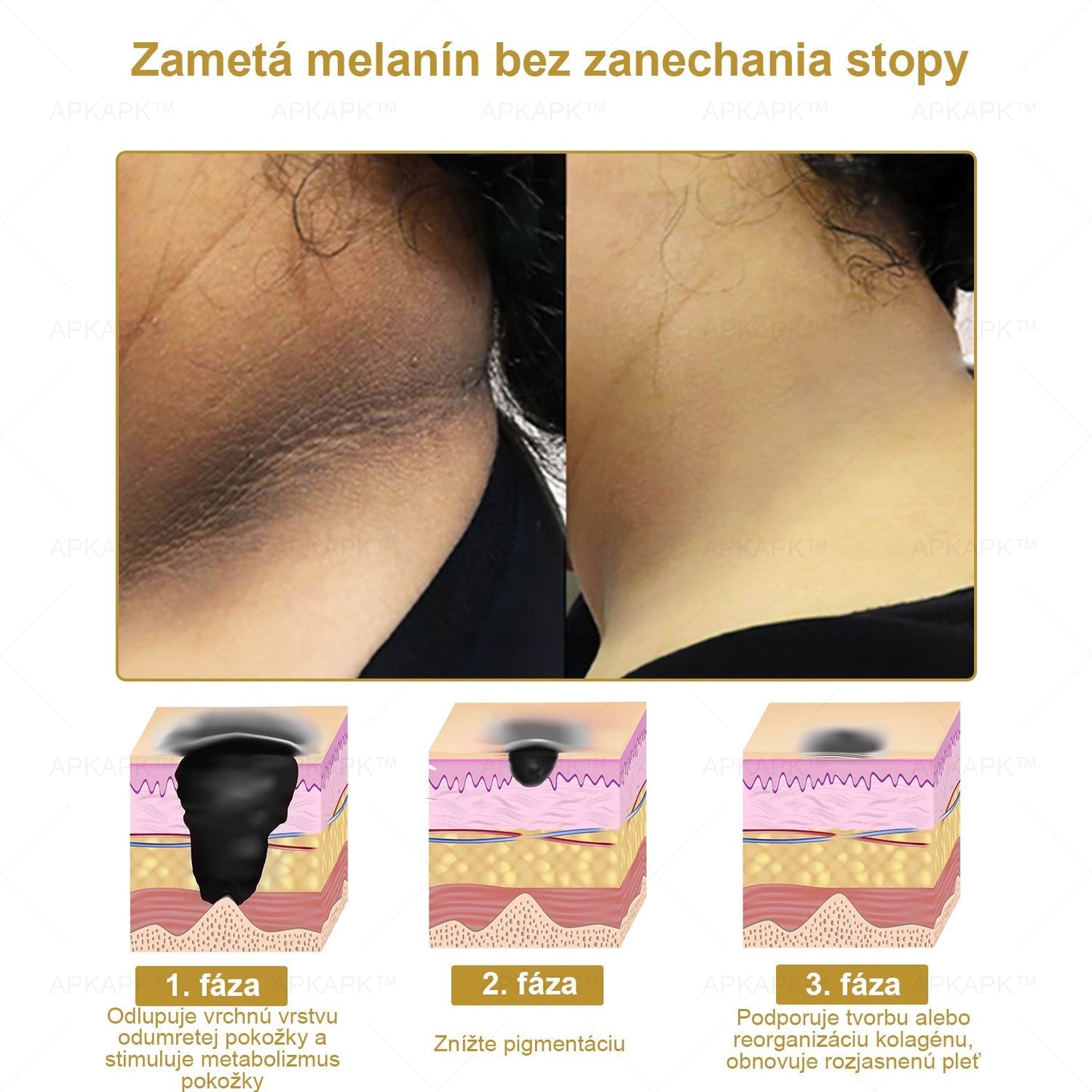 𝐀𝐏𝐊𝐀𝐏𝐊® 𝐕Š𝐄𝐓𝐊𝐎 𝐕 𝐉𝐄𝐃𝐍𝐎𝐌 𝐊𝐫é𝐦 𝐧𝐚 𝐨š𝐞𝐭𝐫𝐞𝐧𝐢𝐞 𝐩𝐨𝐤𝐨ž𝐤𝐲(❄ Nový zimný predaj | ❄ Až do 70% vypnuté)