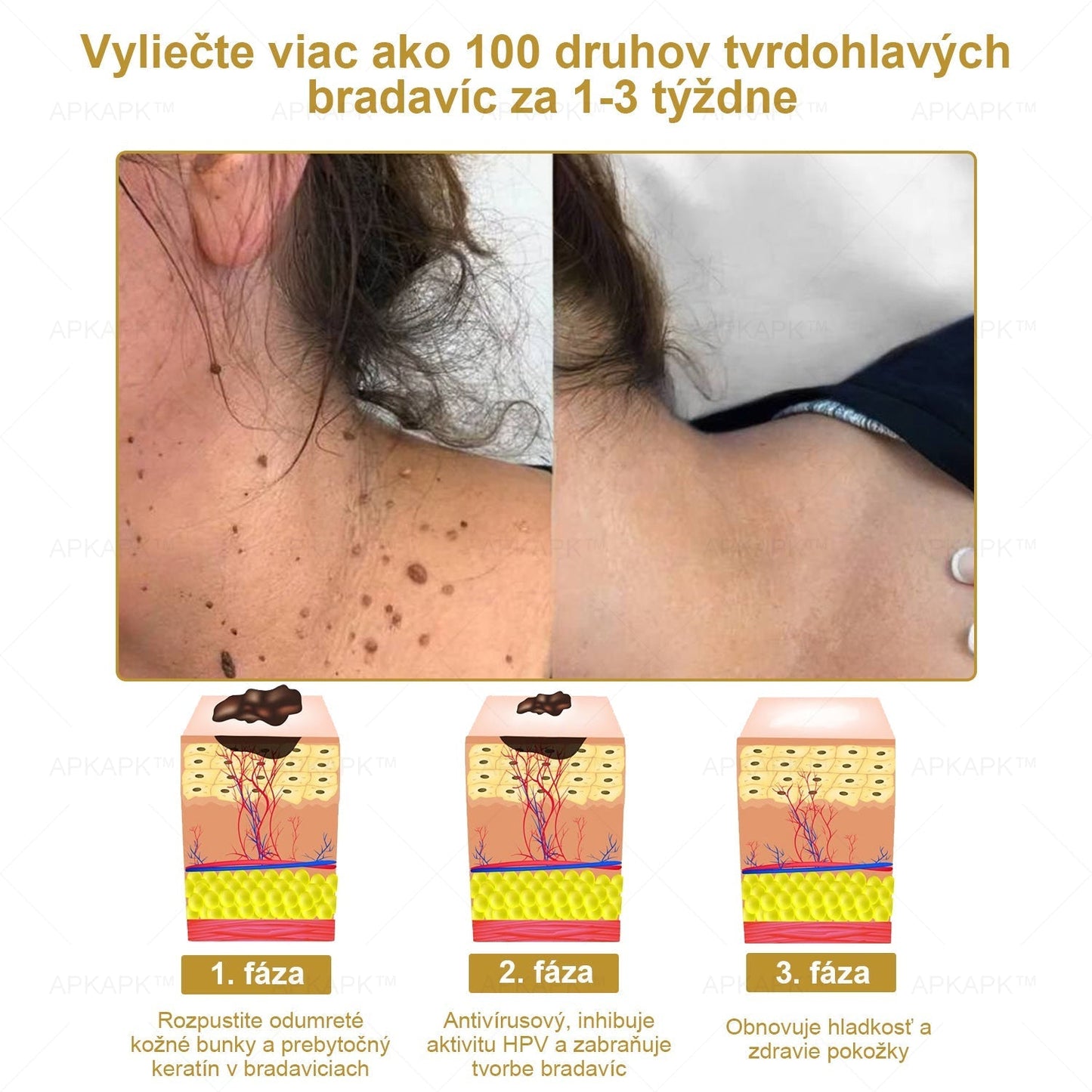 𝐀𝐏𝐊𝐀𝐏𝐊® 𝐕Š𝐄𝐓𝐊𝐎 𝐕 𝐉𝐄𝐃𝐍𝐎𝐌 𝐊𝐫é𝐦 𝐧𝐚 𝐨š𝐞𝐭𝐫𝐞𝐧𝐢𝐞 𝐩𝐨𝐤𝐨ž𝐤𝐲(❄ Nový zimný predaj | ❄ Až do 70% vypnuté)