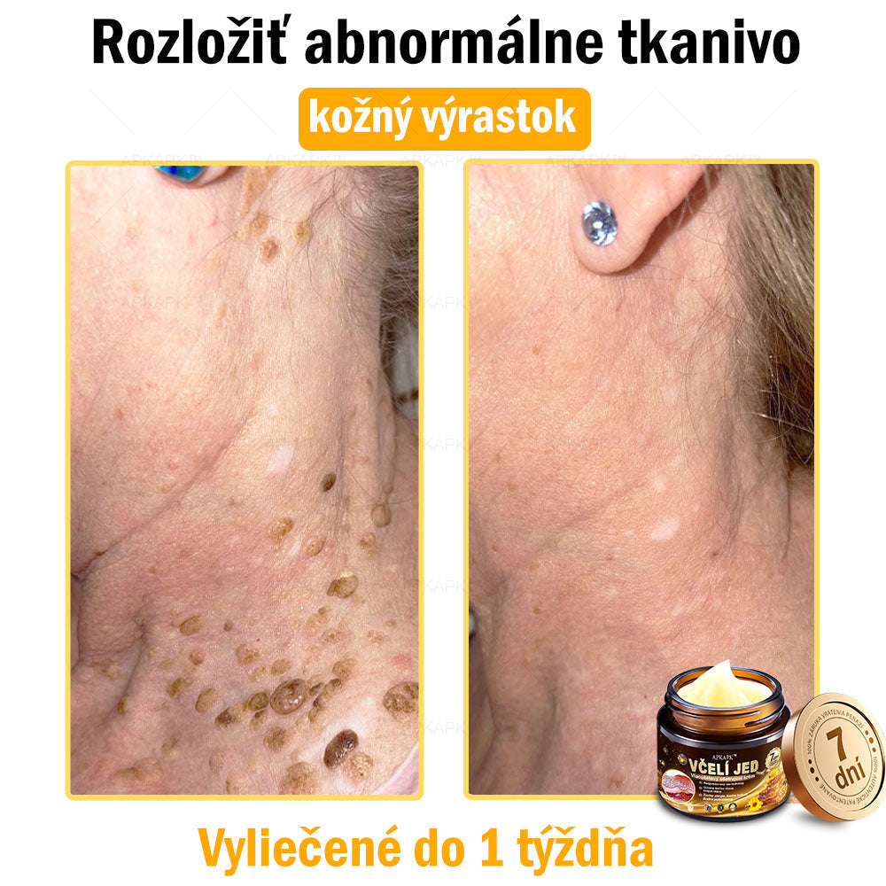 𝐀𝐏𝐊𝐀𝐏𝐊™ 𝐕č𝐞𝐥í 𝐉𝐞𝐝 𝐊𝐫é𝐦 𝐍𝐚 𝐑𝐞𝐠𝐞𝐧𝐞𝐫á𝐜𝐢𝐮 𝐏𝐥𝐞𝐭𝐢 🧑‍⚕️𝐎š𝐞𝐭𝐫𝐞𝐧𝐢𝐞 𝐤𝐨ž𝐧ý𝐜𝐡 𝐩𝐫𝐨𝐛𝐥é𝐦𝐨𝐯 𝐳𝐚𝐡ŕň𝐚: 𝐯𝐞𝐤𝐨𝐯é š𝐤𝐯𝐫𝐧𝐲, 𝐣𝐚𝐳𝐯𝐲, 𝐛𝐫𝐚𝐝𝐚𝐯𝐢𝐜𝐞, 𝐤𝐨ž𝐧é 𝐯ý𝐫𝐚𝐬𝐭𝐤𝐲, 𝐟𝐮𝐫𝐮𝐧𝐤𝐥𝐲, 𝐚𝐤𝐧é, 𝐞𝐤𝐳é𝐦𝐲, 𝐩𝐬𝐨𝐫𝐢á𝐳𝐮, 𝐚𝐤𝐧é 𝐢𝐧𝐯𝐞𝐫𝐬𝐚, 𝐯𝐫á𝐬𝐤𝐲, 𝐬𝐭𝐚𝐫𝐧𝐮𝐭𝐢𝐞 𝐩𝐥𝐞𝐭𝐢 𝐚 ď𝐚𝐥š𝐢𝐞.🔥