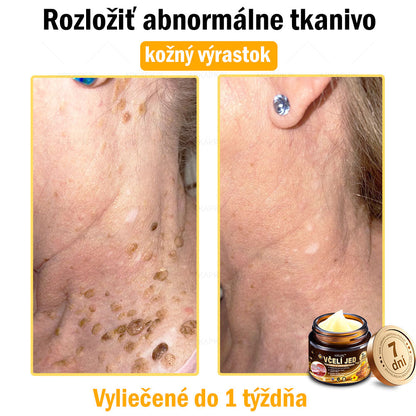 𝐀𝐏𝐊𝐀𝐏𝐊™ 𝐕č𝐞𝐥í 𝐉𝐞𝐝 𝐊𝐫é𝐦 𝐍𝐚 𝐑𝐞𝐠𝐞𝐧𝐞𝐫á𝐜𝐢𝐮 𝐏𝐥𝐞𝐭𝐢 🧑‍⚕️𝐎š𝐞𝐭𝐫𝐞𝐧𝐢𝐞 𝐤𝐨ž𝐧ý𝐜𝐡 𝐩𝐫𝐨𝐛𝐥é𝐦𝐨𝐯 𝐳𝐚𝐡ŕň𝐚: 𝐯𝐞𝐤𝐨𝐯é š𝐤𝐯𝐫𝐧𝐲, 𝐣𝐚𝐳𝐯𝐲, 𝐛𝐫𝐚𝐝𝐚𝐯𝐢𝐜𝐞, 𝐤𝐨ž𝐧é 𝐯ý𝐫𝐚𝐬𝐭𝐤𝐲, 𝐟𝐮𝐫𝐮𝐧𝐤𝐥𝐲, 𝐚𝐤𝐧é, 𝐞𝐤𝐳é𝐦𝐲, 𝐩𝐬𝐨𝐫𝐢á𝐳𝐮, 𝐚𝐤𝐧é 𝐢𝐧𝐯𝐞𝐫𝐬𝐚, 𝐯𝐫á𝐬𝐤𝐲, 𝐬𝐭𝐚𝐫𝐧𝐮𝐭𝐢𝐞 𝐩𝐥𝐞𝐭𝐢 𝐚 ď𝐚𝐥š𝐢𝐞.🔥