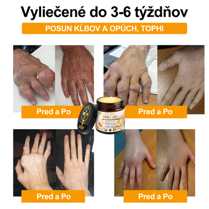 𝐎𝐟𝐢𝐜𝐢á𝐥𝐧𝐲 𝐨𝐛𝐜𝐡𝐨𝐝:𝐙𝐕𝐋𝐙𝐕𝐋™ 🐝𝐕č𝐞𝐥í 𝐣𝐞𝐝 𝐨𝐤𝐚𝐦ž𝐢𝐭ý 𝐮𝐥𝐭𝐫𝐚 𝐬𝐢𝐥𝐧ý 𝐤𝐫é𝐦 𝐩𝐫𝐨𝐭𝐢 𝐛𝐨𝐥𝐞𝐬𝐭𝐢 - (𝐳𝐦𝐢𝐞𝐫ň𝐮𝐣𝐞 𝐛𝐨𝐥𝐞𝐬ť 𝐩𝐫𝐢 𝐚𝐫𝐭𝐫𝐢𝐭í𝐝𝐞, 𝐛𝐨𝐥𝐞𝐬𝐭𝐢 𝐬𝐯𝐚𝐥𝐨𝐯, 𝐜𝐡𝐫𝐛𝐭𝐚, 𝐤𝐨𝐥𝐢𝐞𝐧, 𝐜𝐡𝐫𝐛𝐭𝐚, 𝐫𝐚𝐦𝐢𝐞𝐧, 𝐛𝐨𝐤𝐨𝐯, 𝐳á𝐩ä𝐬𝐭í, 𝐫ú𝐤)🔥