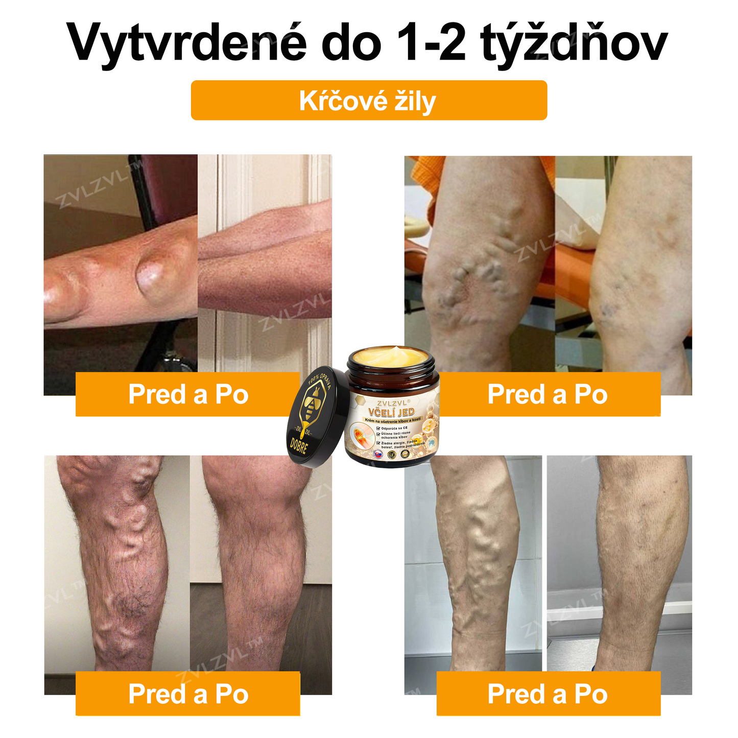 𝐎𝐟𝐢𝐜𝐢á𝐥𝐧𝐲 𝐨𝐛𝐜𝐡𝐨𝐝:𝐙𝐕𝐋𝐙𝐕𝐋™ 🐝𝐕č𝐞𝐥í 𝐣𝐞𝐝 𝐨𝐤𝐚𝐦ž𝐢𝐭ý 𝐮𝐥𝐭𝐫𝐚 𝐬𝐢𝐥𝐧ý 𝐤𝐫é𝐦 𝐩𝐫𝐨𝐭𝐢 𝐛𝐨𝐥𝐞𝐬𝐭𝐢 - (𝐳𝐦𝐢𝐞𝐫ň𝐮𝐣𝐞 𝐛𝐨𝐥𝐞𝐬ť 𝐩𝐫𝐢 𝐚𝐫𝐭𝐫𝐢𝐭í𝐝𝐞, 𝐛𝐨𝐥𝐞𝐬𝐭𝐢 𝐬𝐯𝐚𝐥𝐨𝐯, 𝐜𝐡𝐫𝐛𝐭𝐚, 𝐤𝐨𝐥𝐢𝐞𝐧, 𝐜𝐡𝐫𝐛𝐭𝐚, 𝐫𝐚𝐦𝐢𝐞𝐧, 𝐛𝐨𝐤𝐨𝐯, 𝐳á𝐩ä𝐬𝐭í, 𝐫ú𝐤)🔥