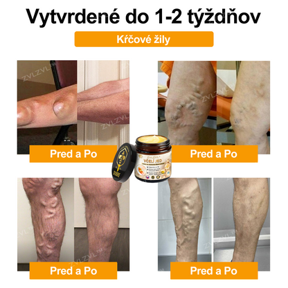 𝐎𝐟𝐢𝐜𝐢á𝐥𝐧𝐲 𝐨𝐛𝐜𝐡𝐨𝐝:𝐙𝐕𝐋𝐙𝐕𝐋™ 🐝𝐕č𝐞𝐥í 𝐣𝐞𝐝 𝐨𝐤𝐚𝐦ž𝐢𝐭ý 𝐮𝐥𝐭𝐫𝐚 𝐬𝐢𝐥𝐧ý 𝐤𝐫é𝐦 𝐩𝐫𝐨𝐭𝐢 𝐛𝐨𝐥𝐞𝐬𝐭𝐢 - (𝐳𝐦𝐢𝐞𝐫ň𝐮𝐣𝐞 𝐛𝐨𝐥𝐞𝐬ť 𝐩𝐫𝐢 𝐚𝐫𝐭𝐫𝐢𝐭í𝐝𝐞, 𝐛𝐨𝐥𝐞𝐬𝐭𝐢 𝐬𝐯𝐚𝐥𝐨𝐯, 𝐜𝐡𝐫𝐛𝐭𝐚, 𝐤𝐨𝐥𝐢𝐞𝐧, 𝐜𝐡𝐫𝐛𝐭𝐚, 𝐫𝐚𝐦𝐢𝐞𝐧, 𝐛𝐨𝐤𝐨𝐯, 𝐳á𝐩ä𝐬𝐭í, 𝐫ú𝐤)🔥