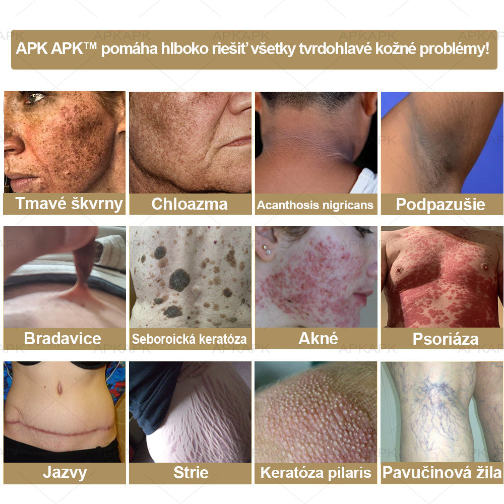 𝐀𝐏𝐊𝐀𝐏𝐊® 𝐕Š𝐄𝐓𝐊𝐎 𝐕 𝐉𝐄𝐃𝐍𝐎𝐌 𝐊𝐫é𝐦 𝐧𝐚 𝐨š𝐞𝐭𝐫𝐞𝐧𝐢𝐞 𝐩𝐨𝐤𝐨ž𝐤𝐲(❄ Nový zimný predaj | ❄ Až do 70% vypnuté)