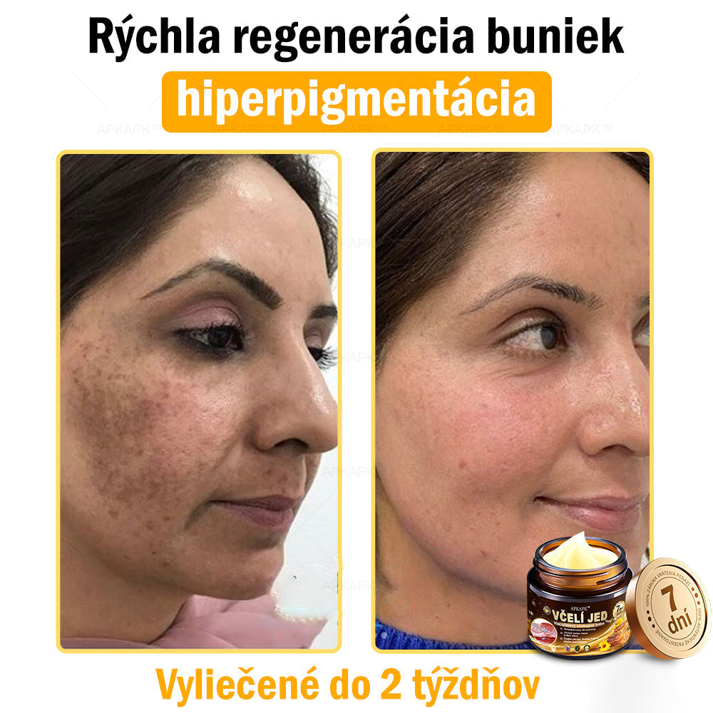 𝐀𝐏𝐊𝐀𝐏𝐊™ 𝐕č𝐞𝐥í 𝐉𝐞𝐝 𝐊𝐫é𝐦 𝐍𝐚 𝐑𝐞𝐠𝐞𝐧𝐞𝐫á𝐜𝐢𝐮 𝐏𝐥𝐞𝐭𝐢 🧑‍⚕️𝐎š𝐞𝐭𝐫𝐞𝐧𝐢𝐞 𝐤𝐨ž𝐧ý𝐜𝐡 𝐩𝐫𝐨𝐛𝐥é𝐦𝐨𝐯 𝐳𝐚𝐡ŕň𝐚: 𝐯𝐞𝐤𝐨𝐯é š𝐤𝐯𝐫𝐧𝐲, 𝐣𝐚𝐳𝐯𝐲, 𝐛𝐫𝐚𝐝𝐚𝐯𝐢𝐜𝐞, 𝐤𝐨ž𝐧é 𝐯ý𝐫𝐚𝐬𝐭𝐤𝐲, 𝐟𝐮𝐫𝐮𝐧𝐤𝐥𝐲, 𝐚𝐤𝐧é, 𝐞𝐤𝐳é𝐦𝐲, 𝐩𝐬𝐨𝐫𝐢á𝐳𝐮, 𝐚𝐤𝐧é 𝐢𝐧𝐯𝐞𝐫𝐬𝐚, 𝐯𝐫á𝐬𝐤𝐲, 𝐬𝐭𝐚𝐫𝐧𝐮𝐭𝐢𝐞 𝐩𝐥𝐞𝐭𝐢 𝐚 ď𝐚𝐥š𝐢𝐞.🔥