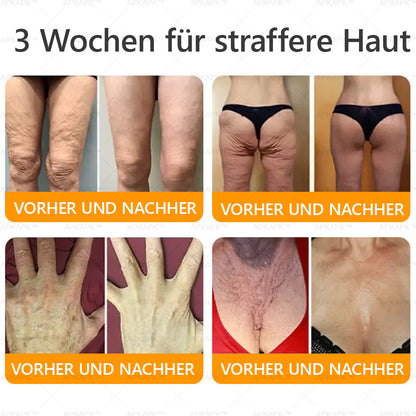 Hergestellt und versendet aus Deutschland ✨ APKAPK® Bienengift Umfassende Creme 🔥 LETZTER TAG 80 % RABATT 🌟