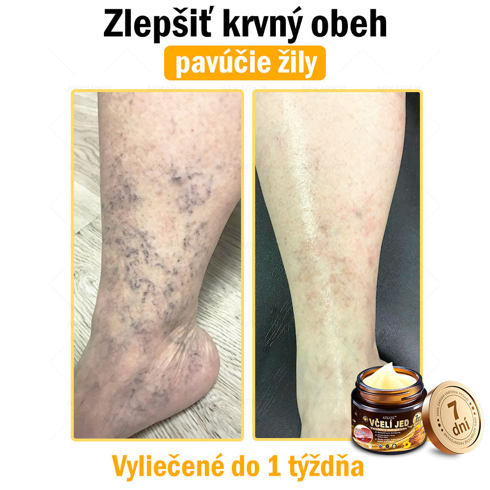 𝐀𝐏𝐊𝐀𝐏𝐊™ 𝐕č𝐞𝐥í 𝐉𝐞𝐝 𝐊𝐫é𝐦 𝐍𝐚 𝐑𝐞𝐠𝐞𝐧𝐞𝐫á𝐜𝐢𝐮 𝐏𝐥𝐞𝐭𝐢 🧑‍⚕️𝐎š𝐞𝐭𝐫𝐞𝐧𝐢𝐞 𝐤𝐨ž𝐧ý𝐜𝐡 𝐩𝐫𝐨𝐛𝐥é𝐦𝐨𝐯 𝐳𝐚𝐡ŕň𝐚: 𝐯𝐞𝐤𝐨𝐯é š𝐤𝐯𝐫𝐧𝐲, 𝐣𝐚𝐳𝐯𝐲, 𝐛𝐫𝐚𝐝𝐚𝐯𝐢𝐜𝐞, 𝐤𝐨ž𝐧é 𝐯ý𝐫𝐚𝐬𝐭𝐤𝐲, 𝐟𝐮𝐫𝐮𝐧𝐤𝐥𝐲, 𝐚𝐤𝐧é, 𝐞𝐤𝐳é𝐦𝐲, 𝐩𝐬𝐨𝐫𝐢á𝐳𝐮, 𝐚𝐤𝐧é 𝐢𝐧𝐯𝐞𝐫𝐬𝐚, 𝐯𝐫á𝐬𝐤𝐲, 𝐬𝐭𝐚𝐫𝐧𝐮𝐭𝐢𝐞 𝐩𝐥𝐞𝐭𝐢 𝐚 ď𝐚𝐥š𝐢𝐞.🔥