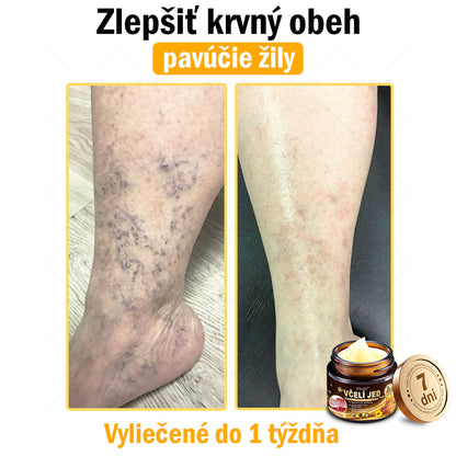 𝐀𝐏𝐊𝐀𝐏𝐊™ 𝐕č𝐞𝐥í 𝐉𝐞𝐝 𝐊𝐫é𝐦 𝐍𝐚 𝐑𝐞𝐠𝐞𝐧𝐞𝐫á𝐜𝐢𝐮 𝐏𝐥𝐞𝐭𝐢 🧑‍⚕️𝐎š𝐞𝐭𝐫𝐞𝐧𝐢𝐞 𝐤𝐨ž𝐧ý𝐜𝐡 𝐩𝐫𝐨𝐛𝐥é𝐦𝐨𝐯 𝐳𝐚𝐡ŕň𝐚: 𝐯𝐞𝐤𝐨𝐯é š𝐤𝐯𝐫𝐧𝐲, 𝐣𝐚𝐳𝐯𝐲, 𝐛𝐫𝐚𝐝𝐚𝐯𝐢𝐜𝐞, 𝐤𝐨ž𝐧é 𝐯ý𝐫𝐚𝐬𝐭𝐤𝐲, 𝐟𝐮𝐫𝐮𝐧𝐤𝐥𝐲, 𝐚𝐤𝐧é, 𝐞𝐤𝐳é𝐦𝐲, 𝐩𝐬𝐨𝐫𝐢á𝐳𝐮, 𝐚𝐤𝐧é 𝐢𝐧𝐯𝐞𝐫𝐬𝐚, 𝐯𝐫á𝐬𝐤𝐲, 𝐬𝐭𝐚𝐫𝐧𝐮𝐭𝐢𝐞 𝐩𝐥𝐞𝐭𝐢 𝐚 ď𝐚𝐥š𝐢𝐞.🔥