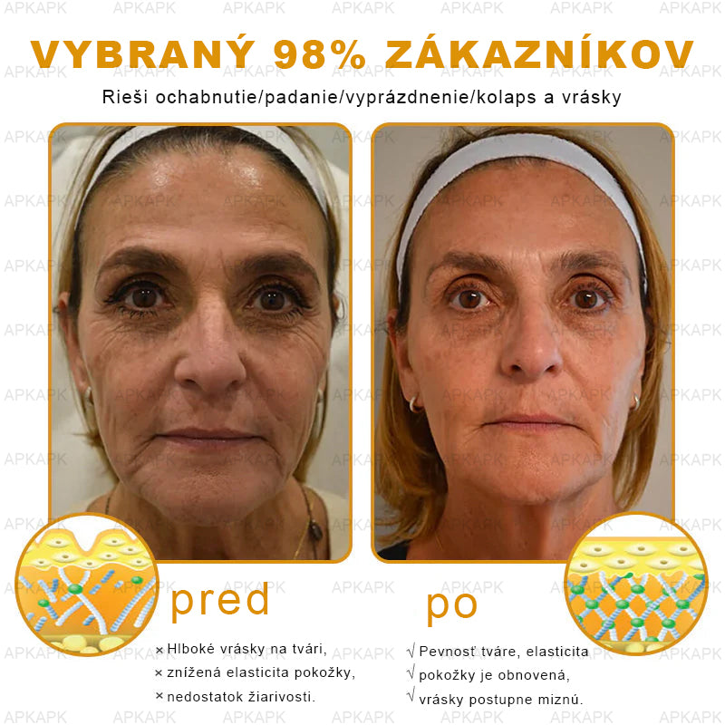 𝐀𝐏𝐊𝐀𝐏𝐊™ 𝐕č𝐞𝐥í 𝐉𝐞𝐝 𝐊𝐫é𝐦 𝐍𝐚 𝐑𝐞𝐠𝐞𝐧𝐞𝐫á𝐜𝐢𝐮 𝐏𝐥𝐞𝐭𝐢
