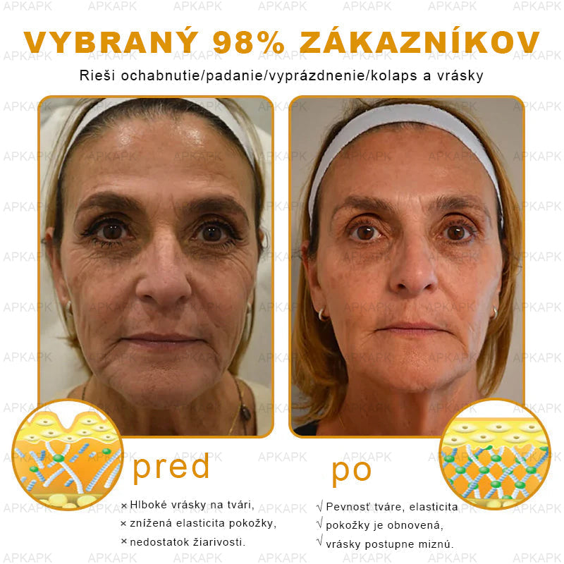 𝐀𝐏𝐊𝐀𝐏𝐊™ 𝐕č𝐞𝐥í 𝐉𝐞𝐝 𝐊𝐫é𝐦 𝐍𝐚 𝐑𝐞𝐠𝐞𝐧𝐞𝐫á𝐜𝐢𝐮 𝐏𝐥𝐞𝐭𝐢 🧑‍⚕️𝐎š𝐞𝐭𝐫𝐞𝐧𝐢𝐞 𝐤𝐨ž𝐧ý𝐜𝐡 𝐩𝐫𝐨𝐛𝐥é𝐦𝐨𝐯 𝐳𝐚𝐡ŕň𝐚: 𝐯𝐞𝐤𝐨𝐯é š𝐤𝐯𝐫𝐧𝐲, 𝐣𝐚𝐳𝐯𝐲, 𝐛𝐫𝐚𝐝𝐚𝐯𝐢𝐜𝐞, 𝐤𝐨ž𝐧é 𝐯ý𝐫𝐚𝐬𝐭𝐤𝐲, 𝐟𝐮𝐫𝐮𝐧𝐤𝐥𝐲, 𝐚𝐤𝐧é, 𝐞𝐤𝐳é𝐦𝐲, 𝐩𝐬𝐨𝐫𝐢á𝐳𝐮, 𝐚𝐤𝐧é 𝐢𝐧𝐯𝐞𝐫𝐬𝐚, 𝐯𝐫á𝐬𝐤𝐲, 𝐬𝐭𝐚𝐫𝐧𝐮𝐭𝐢𝐞 𝐩𝐥𝐞𝐭𝐢 𝐚 ď𝐚𝐥š𝐢𝐞.🔥